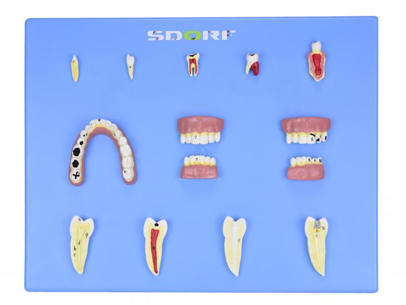 MODELO DE PATOLOGIAS DENTÁRIAS C/ 12 PARTES EM PLACA