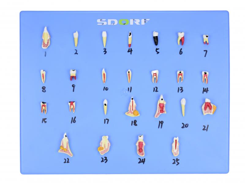 MODELO DE PATOLOGIAS DENTÁRIAS C/ 25 PARTES EM PLACA