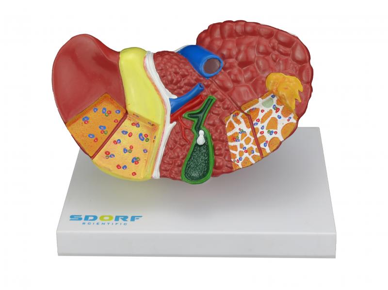 MODELO PATOLÓGICO DO FÍGADO E VESÍCULA BILIAR